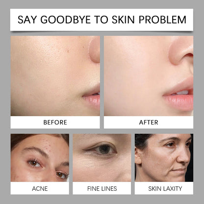 Bee Venom Repair & Nourish Face Mask Zyvina Co™